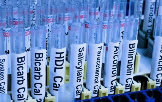 Unklare Symptome, Leaky Gut und Zonulin